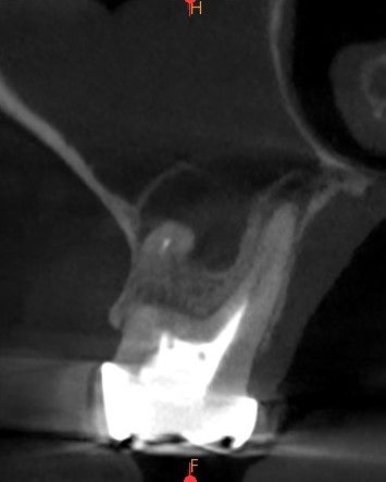 Endodoncia 1