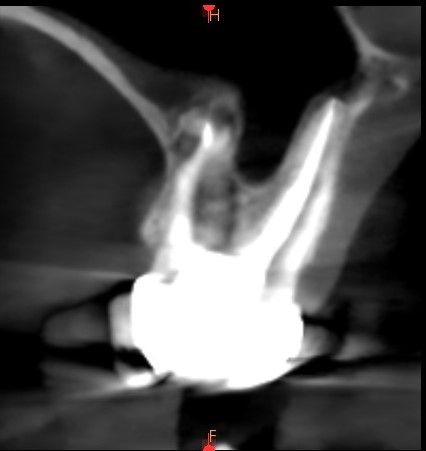 Endodoncia 2